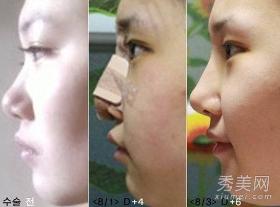 ʵ�ģ�����Ů�����ݹ��� ���ǳ�̫֬�ֲ�