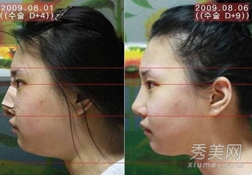 ʵ�ģ�����Ů�����ݹ��� ���ǳ�̫֬�ֲ�