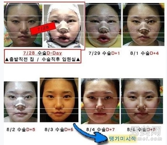 ʵ�ģ�����Ů�����ݹ��� ���ǳ�̫֬�ֲ�