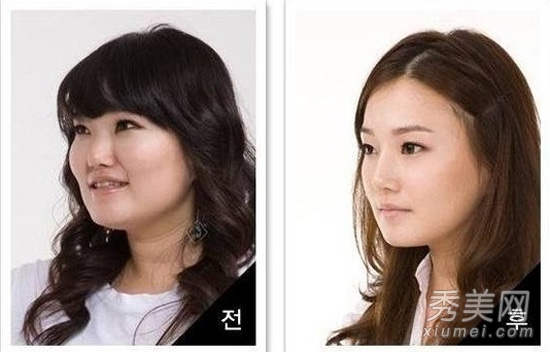 ʵ�ģ�����Ů�����ݹ��� ���ǳ�̫֬�ֲ�