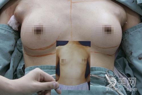 �𺳣�ʵ���ձ�Ů�ӹ轺¡������ȫ����