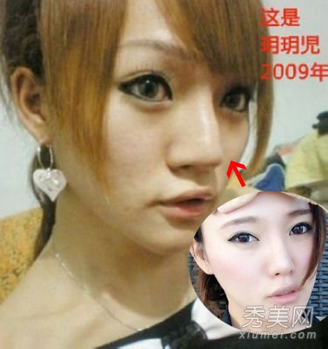 �̲���ﾲ�����еģ���¶˽�ս�����ʵ��ò