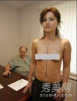 超震撼!实拍美女假体隆胸手术全过程