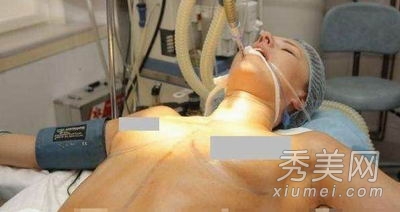 超震撼!实拍美女假体隆胸手术全过程