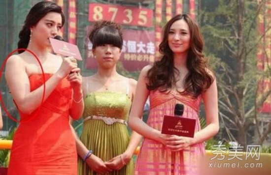 �³�ɩ��ܿ�۱��� Ů�Ƿ���ǰ��Ա�