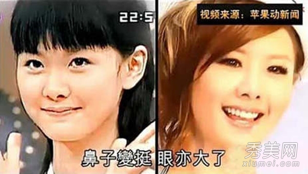 “C字裤女王”安心亚 整容后似AV女优