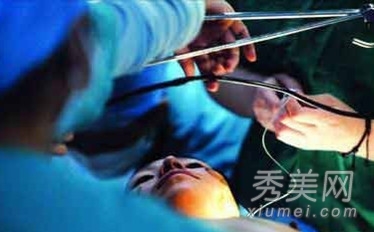 ������α��Ů�� ͼ�ұ���������ϸȫ����