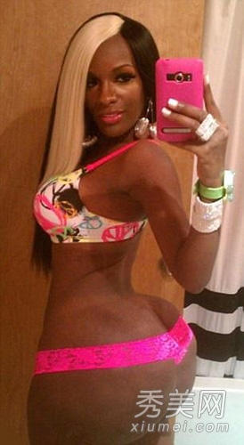 图揭20位最吓人的整形失败女星案例