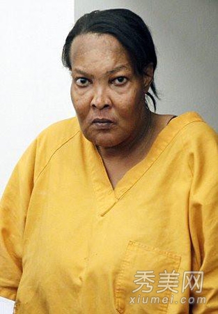 图揭20位最吓人的整形失败女星案例