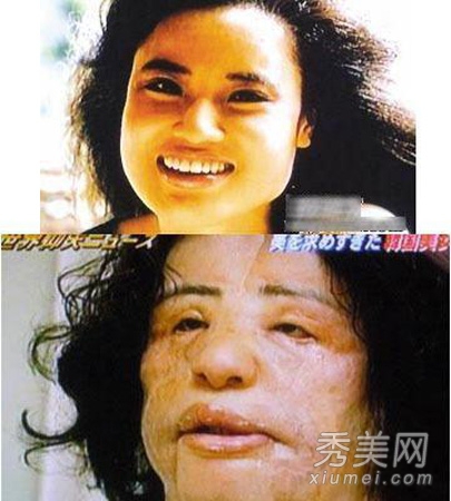图揭20位最吓人的整形失败女星案例