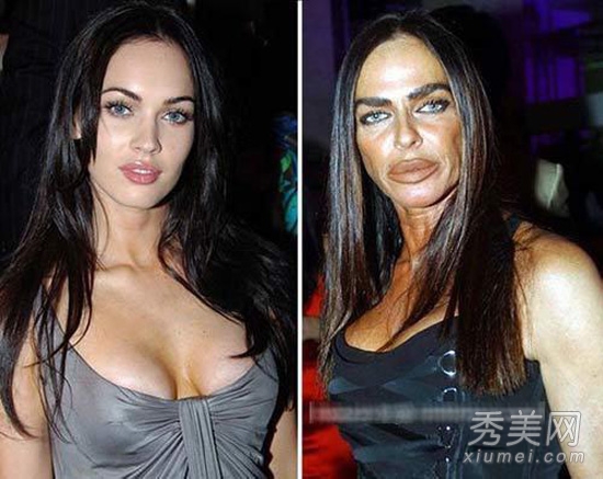 图揭20位最吓人的整形失败女星案例