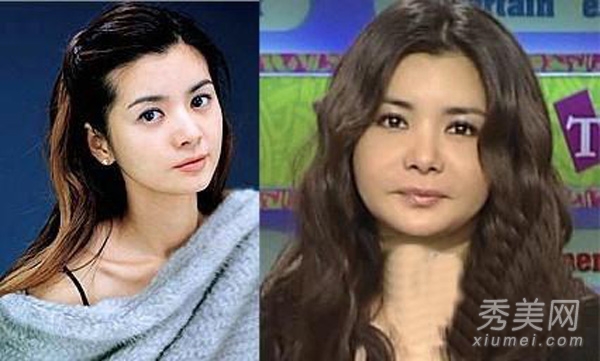 图揭20位最吓人的整形失败女星案例