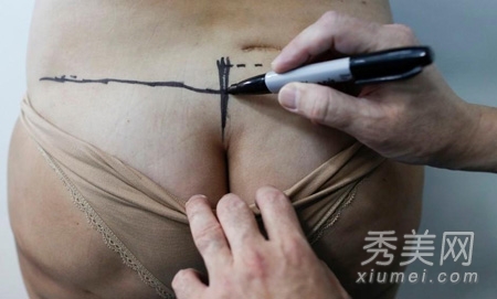 图揭20位最吓人的整形失败女星案例