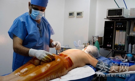 图揭20位最吓人的整形失败女星案例