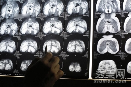 图揭20位最吓人的整形失败女星案例