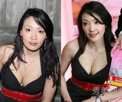 安雅产后暴肥 昔日三级片女星发福变残