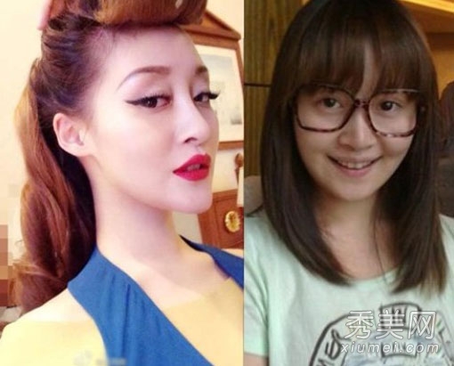 徐海星整容再出山 今昔对比样貌大变