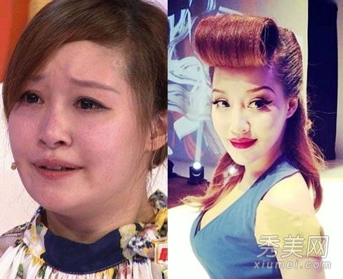 徐海星整容再出山 今昔对比样貌大变