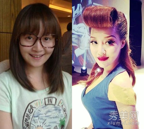 徐海星整容再出山 今昔对比样貌大变