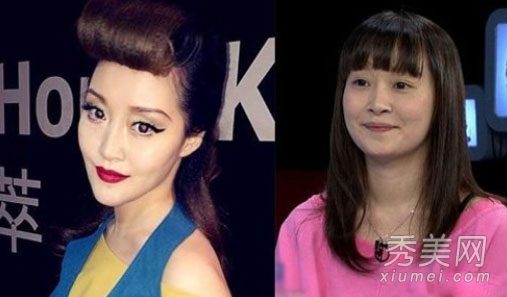 徐海星整容再出山 今昔对比样貌大变