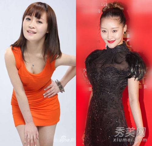 徐海星整容再出山 今昔对比样貌大变