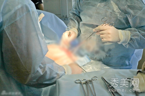 产房直击 实拍剖腹产手术全过程图片