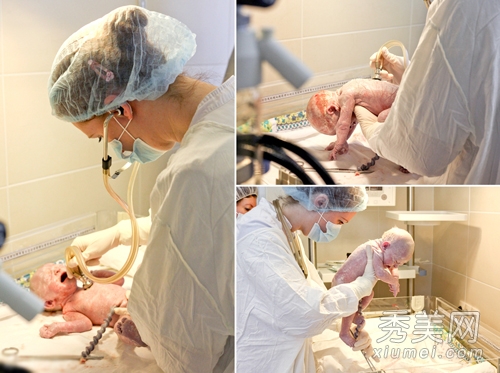 产房直击 实拍剖腹产手术全过程图片