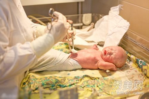 产房直击 实拍剖腹产手术全过程图片