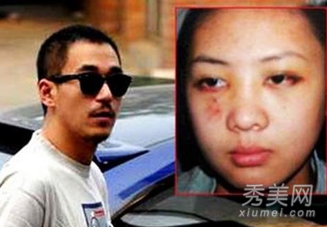 张默再次吸毒被抓 暴打女友威胁记者历年丑闻盘点