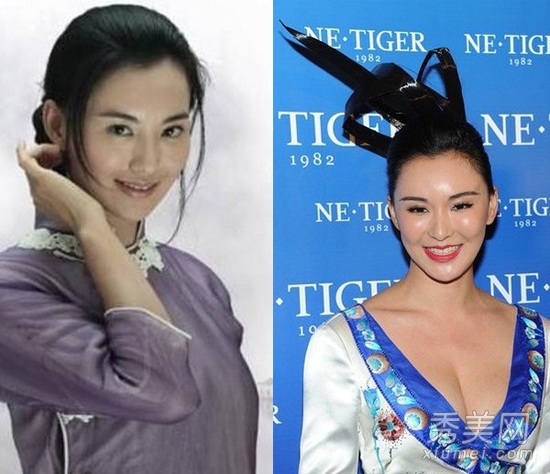 官恩娜面瘫嘴歪眼斜 明星整容后遗症可怕