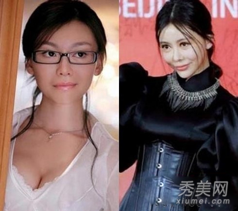 官恩娜面瘫嘴歪眼斜 明星整容后遗症可怕