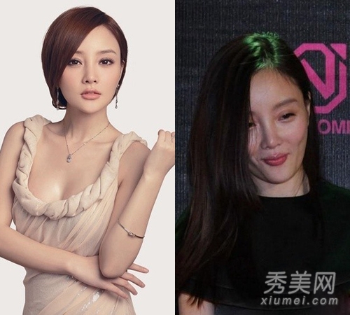 官恩娜面瘫嘴歪眼斜 明星整容后遗症可怕