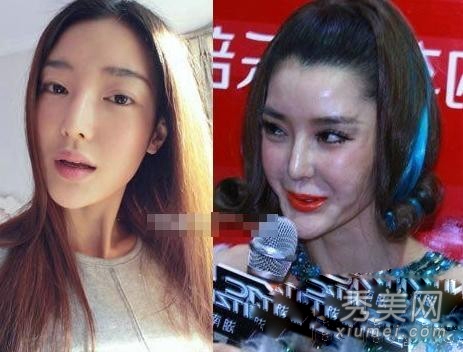 官恩娜面瘫嘴歪眼斜 明星整容后遗症可怕