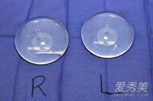 ʵ��Ů��¡������ȫ���� ��Ѫ�ȸҿ���