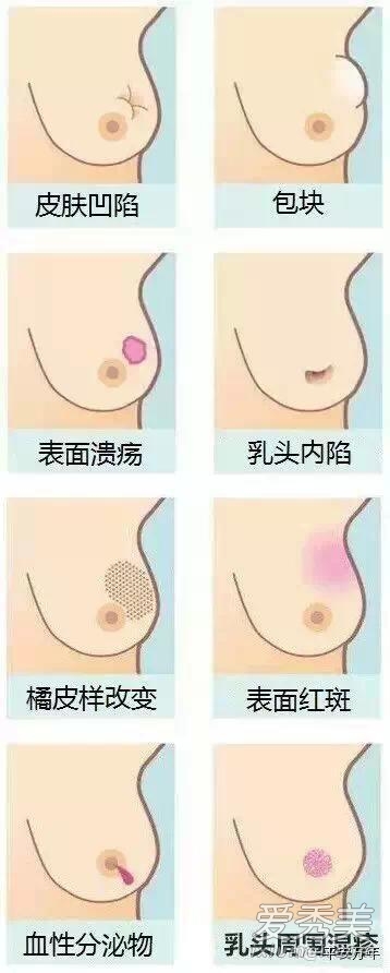 Ů�Աؿ������ٰ�����֢״�Բ�ͼ