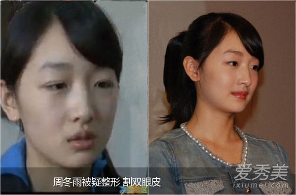 �ܶ��걻������ ��90��Ů�����ݶԱ���