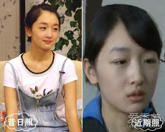 周冬雨被疑整容 看90后女星整容对比照