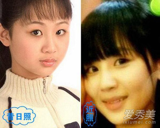 周冬雨被疑整容 看90后女星整容对比照