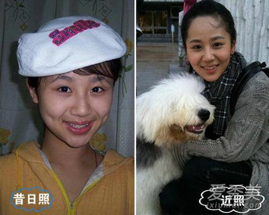 周冬雨被疑整容 看90后女星整容对比照