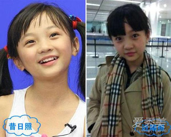 周冬雨被疑整容 看90后女星整容对比照