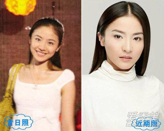 周冬雨被疑整容 看90后女星整容对比照