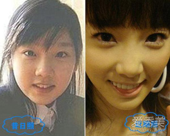 周冬雨被疑整容 看90后女星整容对比照