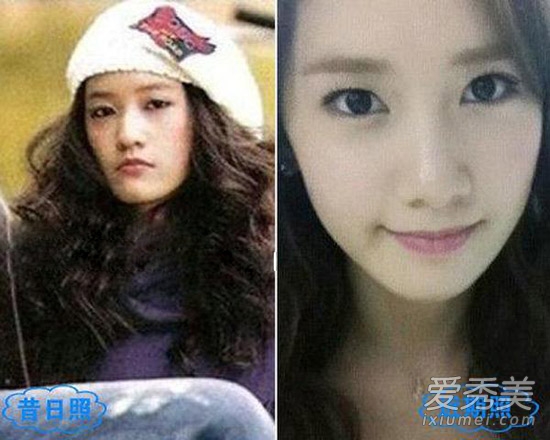 周冬雨被疑整容 看90后女星整容对比照