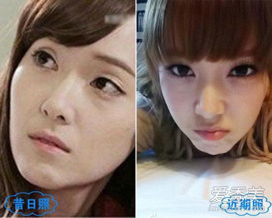 周冬雨被疑整容 看90后女星整容对比照