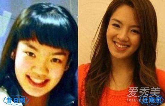 周冬雨被疑整容 看90后女星整容对比照