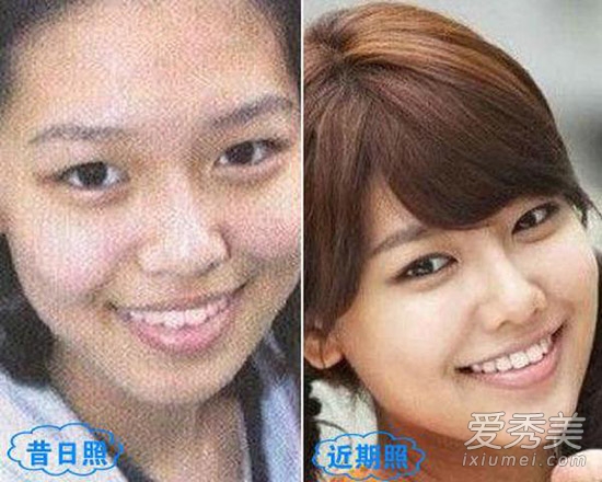 周冬雨被疑整容 看90后女星整容对比照