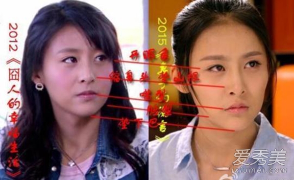 贾青整容前后对比照 富二代男友曝光