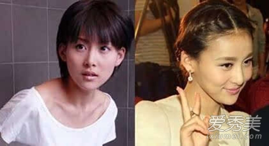 贾青整容前后对比照 富二代男友曝光