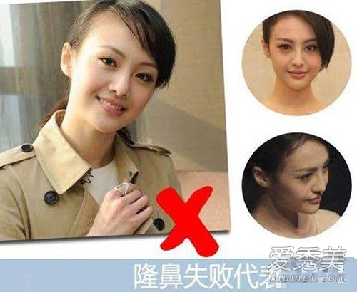 ���컨�������ֵPK �����۾���Ư��