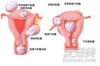 (图解)女人阴道的神秘模样你了解吗?
